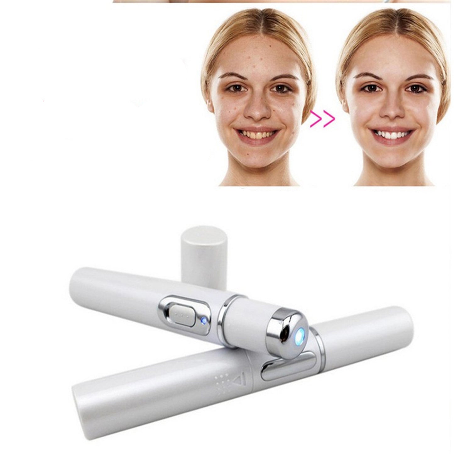 Photon Beauty Pen – wrinkle, blemish and pore remover