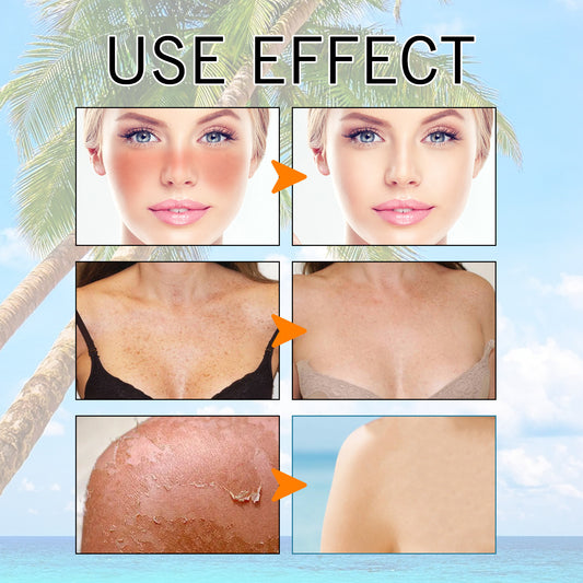 Hyaluron acid moisturizing protective gel summer outdoor moisturizing, non-oily, UV rays